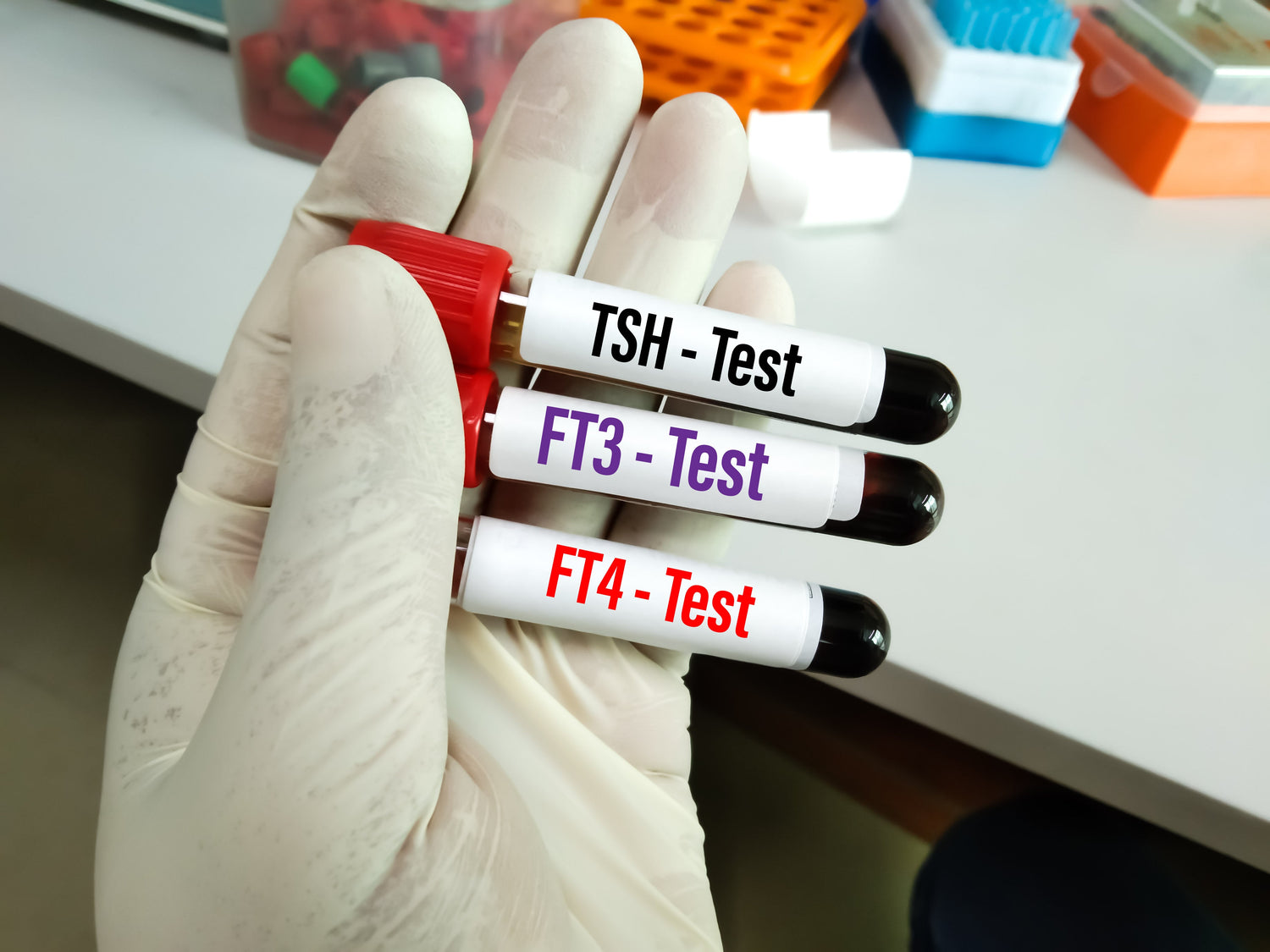 Thyroid Profile Package